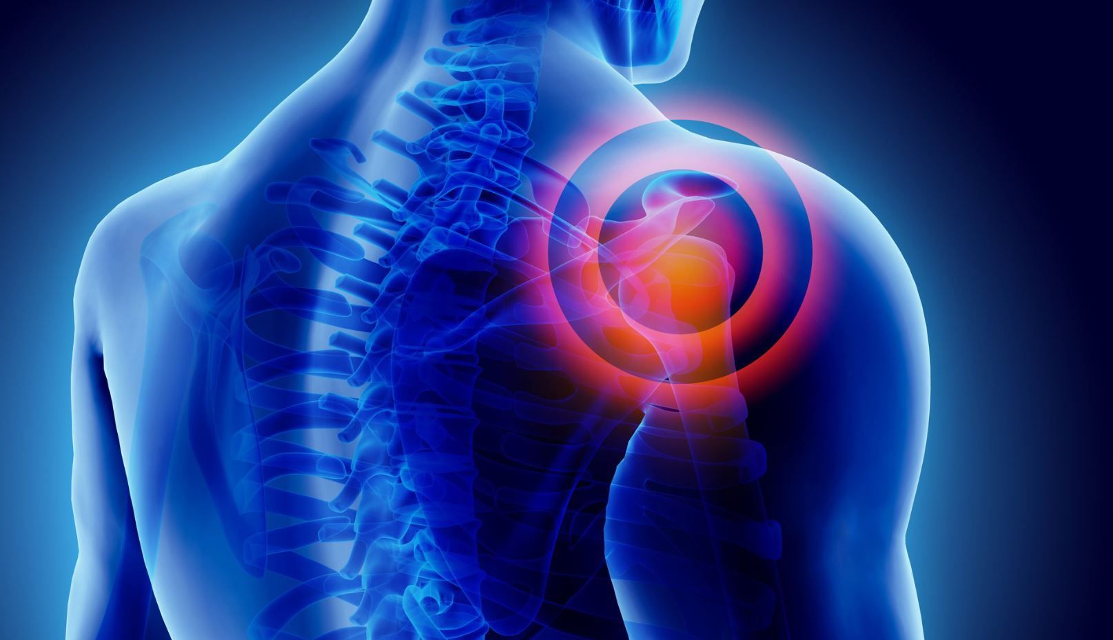 Neck and Shoulder Pain